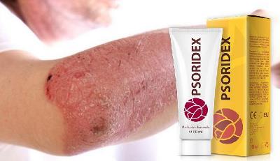 Psoridex tratament de psoriazis, ingrediente, mod de administrare