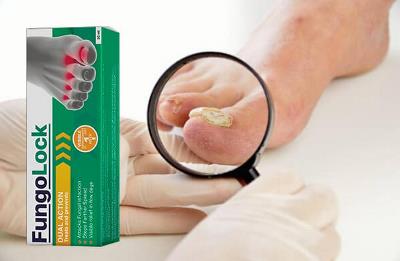 Fungolock tratament pentru ciuperca piciorului, prospect, Romania